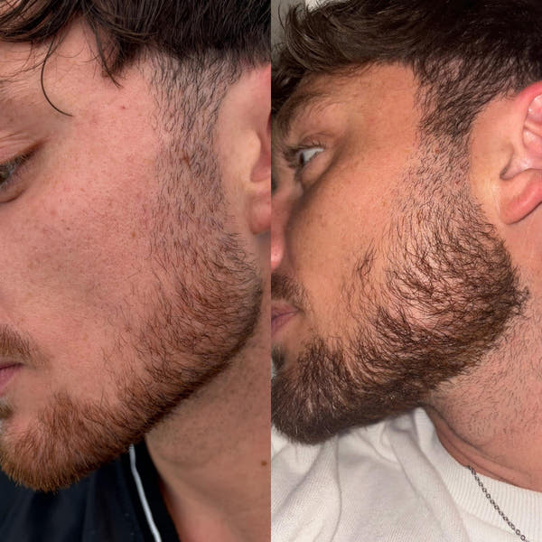 Be BodyWise - Hair Growth Serum™