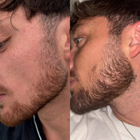 Be BodyWise - Hair Growth Serum™