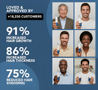 Hair Growth Serum Roller™