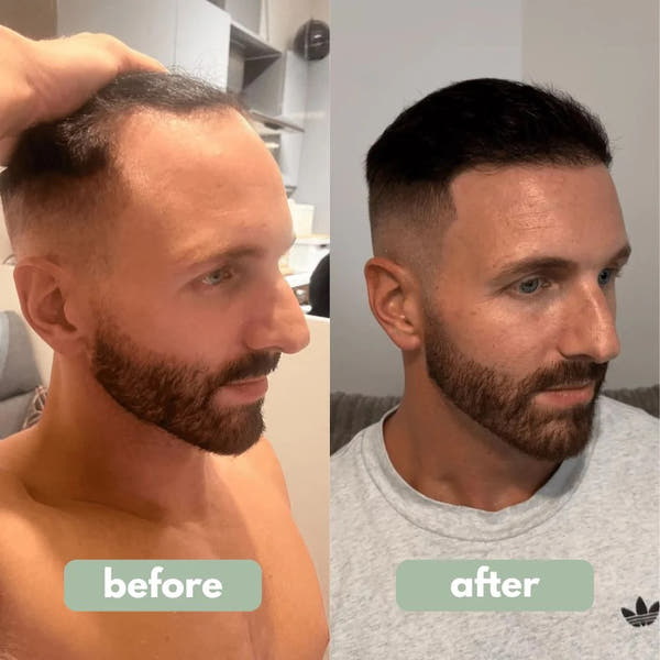 Be BodyWise - Hair Growth Serum™