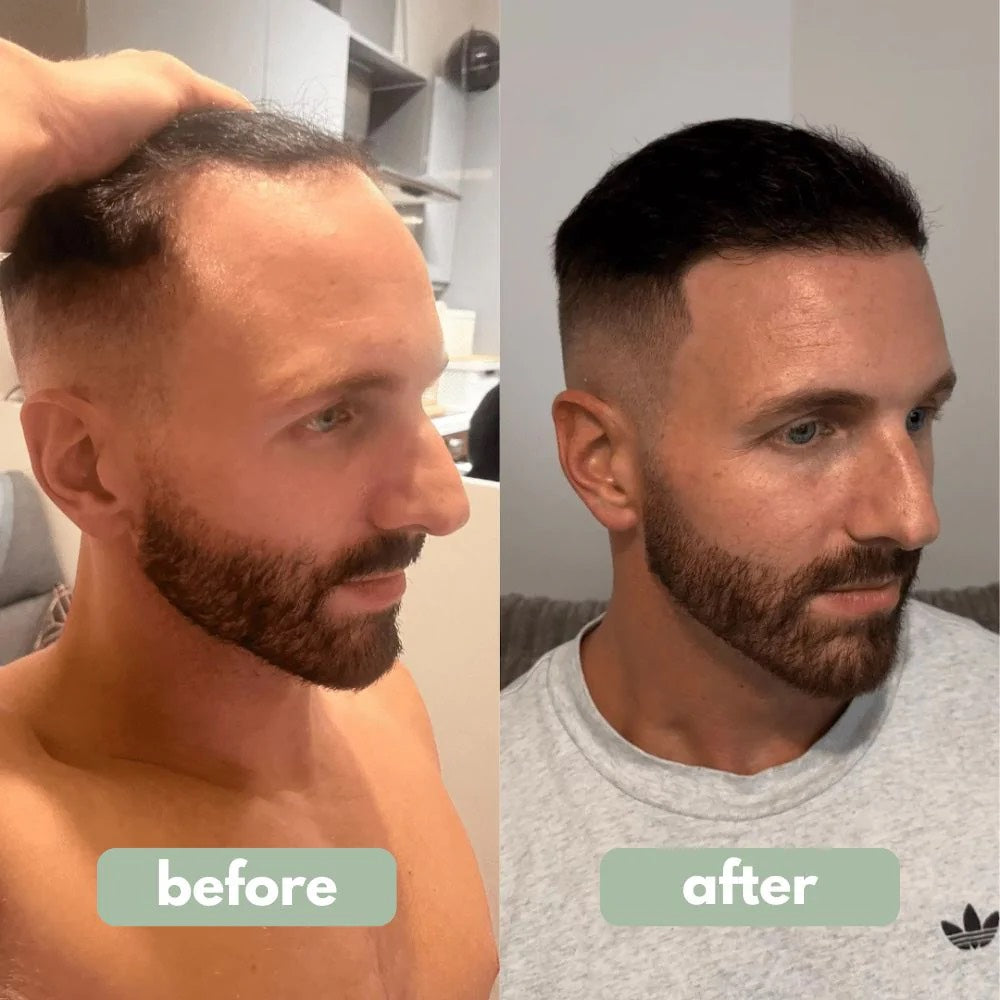 Be BodyWise - Hair Growth Serum™