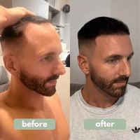 Be BodyWise - Hair Growth Serum™