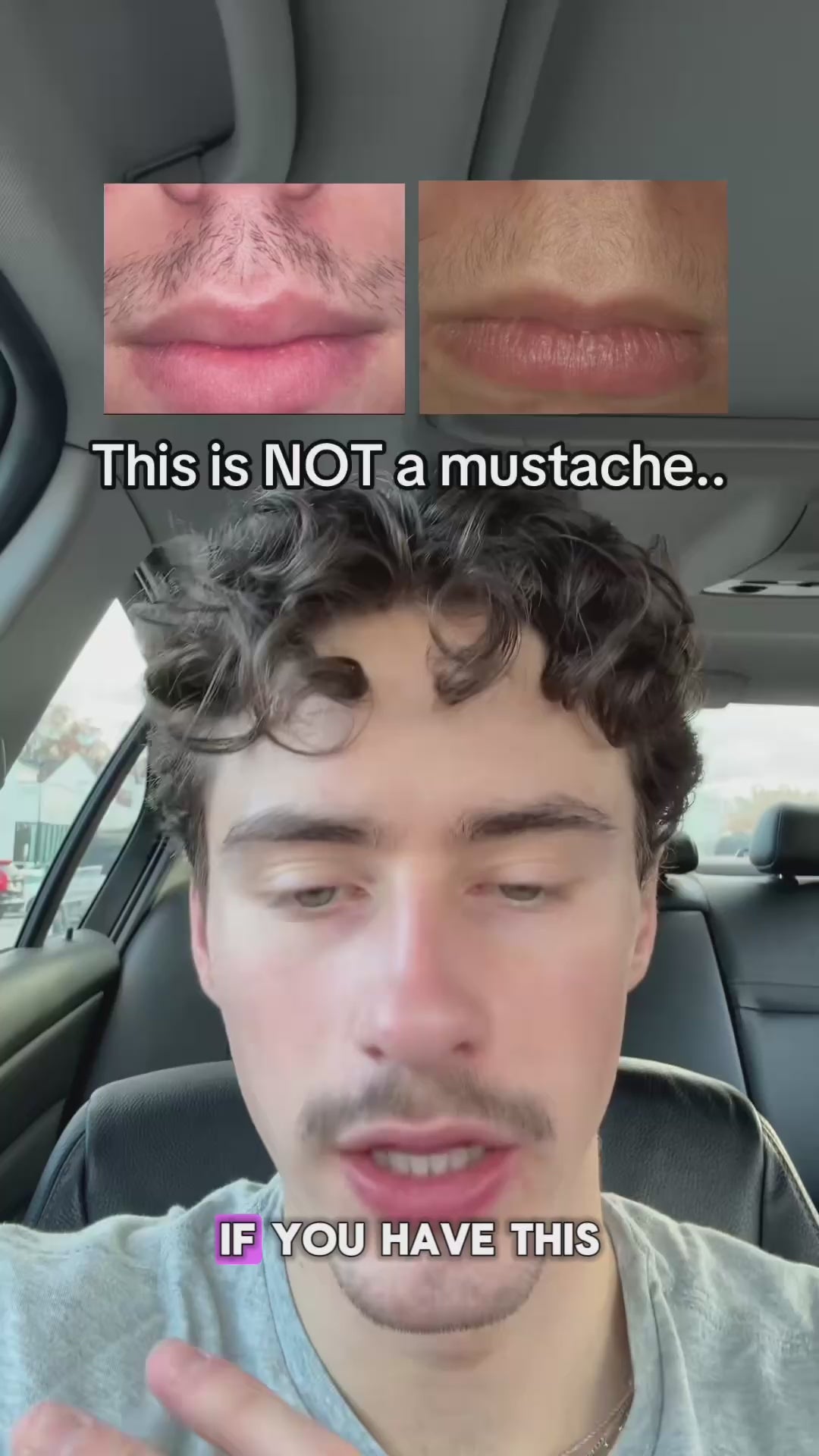 Hair Growth Serum Roller™ video