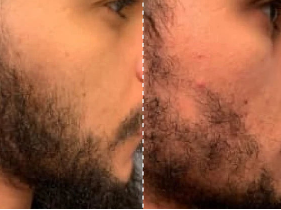 Hair Growth Serum Roller™